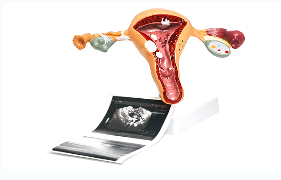 Anatomical model of the uterus beside printed ultrasound scans