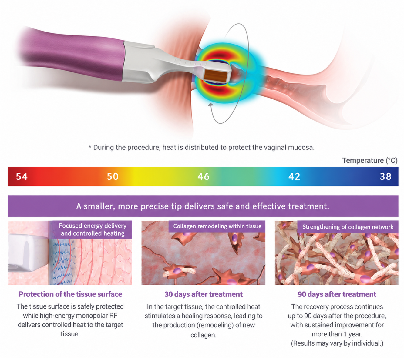 Infographic showing controlled heat distribution and collagen remodeling over 90 days